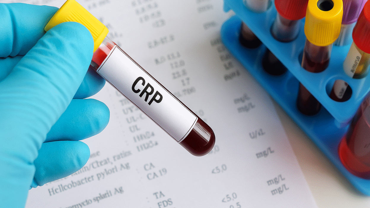 C Reaktif Protein (CRP) Nedir